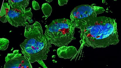 Estas son células en suspensión (monocitos THP-1) tratadas con nanoplásticos (PET). Para visualizar los diferentes compartimentos celulares, se han teñido con distintos fluorocromos: en verde se muestra la membrana celular teñida con CellMask, en azul el núcleo celular teñido con Hoechst, y en rojo los nanoplásticos teñidos con iDye Poly Pink (un colorante textil).

La imagen ha sido obtenida con un microscopio confocal de barrido láser, que emplea láseres de distintas longitudes de onda para excitar los fluorocromos y detectar su emisión. Concretamente, se trata de una representación 3D en la que se ha realizado un corte transversal para observar el interior de las células. En la imagen se aprecian los nanoplásticos (en rojo) dentro del citoplasma celular, muy cerca del núcleo (en azul), o incluso en contacto con él.
