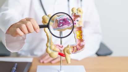 La enfermedad inflamatoria intestinal, que engloba tanto la enfermedad de Crohn como la colitis ulcerosa, afecta a un 1% de la población y suele diagnosticarse entre los 15 y los 30 años.